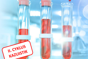 Co nabídl II. cyklus kazuistik z hematologické a hematoonkologické praxe