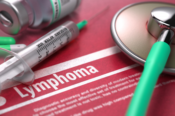 Difuzní velkobuněčný B‑lymfom ‑ diagnostika a léčba
