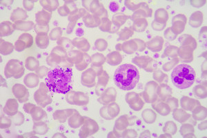 Atlas hematologických fotografií