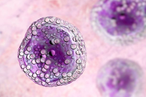 Diagnostické a léčebné postupy u nemocných s maligními lymfomy (XV. vydání)