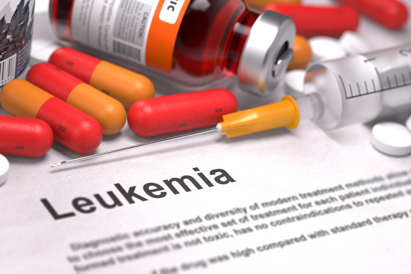 Imunoglobulinová substituční terapie neprokázala snížení výskytu závažných infekcí u chronické lymfocytární leukémie
