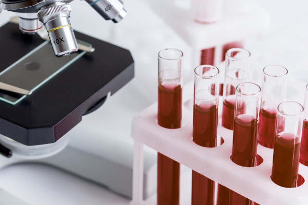 Evoluční a klinické důsledky rozdílů v prokoagulačních vlastnostech jedů australských hadů rodu Elapidae